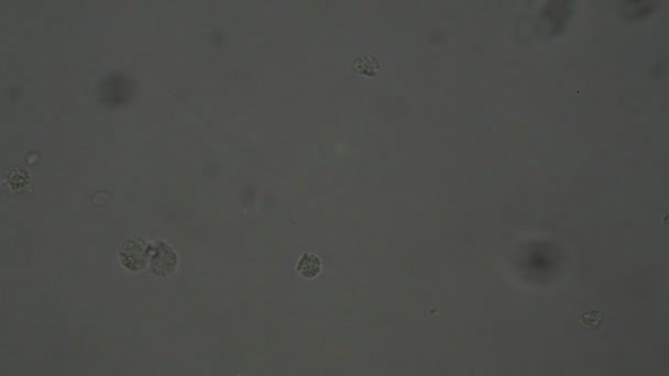 Glóbulos Blancos Humanos Bajo Microscopio — Vídeo de stock