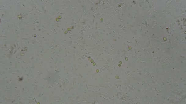 Ontluikende Gistcellen Onder Microscoop — Stockvideo