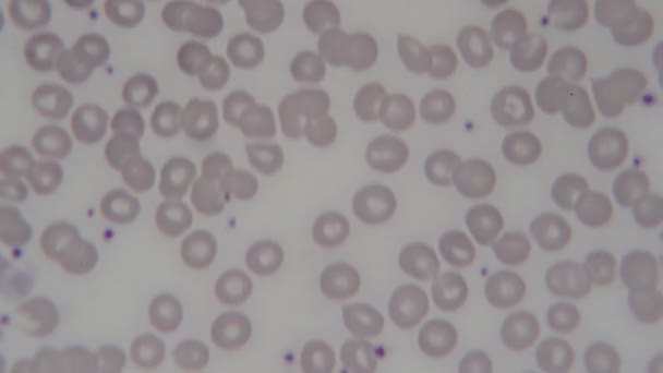 Células Sanguíneas Humanas Bajo Microscopio — Vídeo de stock