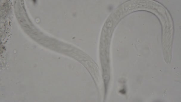 Parasit Strongyloides Stercoralis Från Mänsklig Avföring Mikroskop Provning Laboratorium — Stockvideo