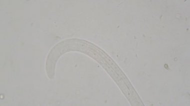 Strongyloides stercoralis mikroskop altında insan dışkısı. laboratuarda test ediliyor