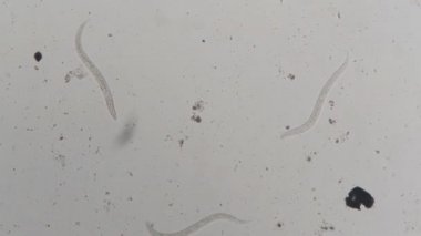Strongyloides stercoralis mikroskop altında insan dışkısı. laboratuarda test ediliyor