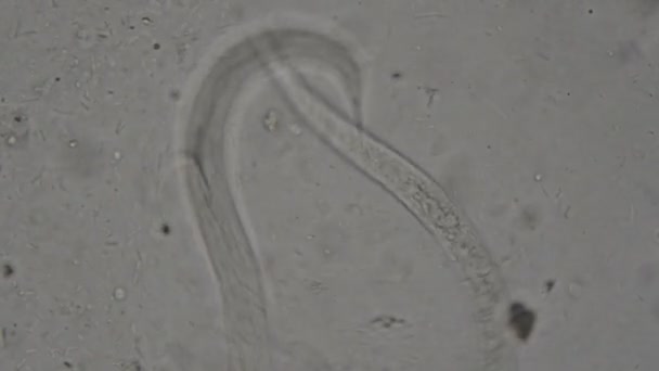 Parásito Strongyloides Stercoralis Heces Humanas Bajo Microscopio Pruebas Laboratorio — Vídeos de Stock