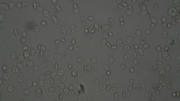 Células Sanguíneas Humanas Bajo Microscopio — Vídeo de stock