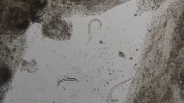 Strongyloides stercoralis mikroskop altında insan dışkısı. laboratuarda test ediliyor