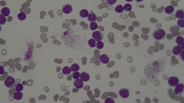 Cellule Del Sangue Umano Microscopio — Video Stock