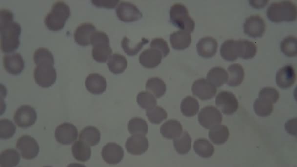 Клетки Крови Человека Микроскопом — стоковое видео