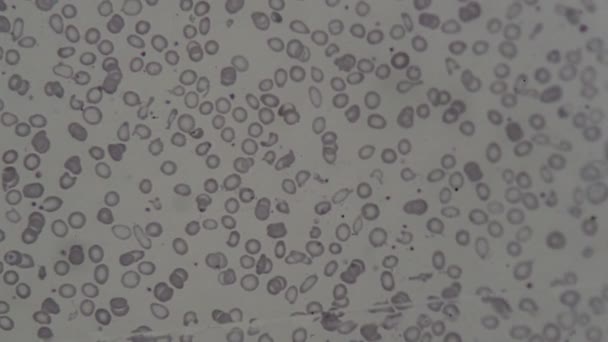 Cellules Sanguines Humaines Microscope — Video