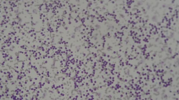 Células Sanguíneas Humanas Bajo Microscopio — Vídeos de Stock