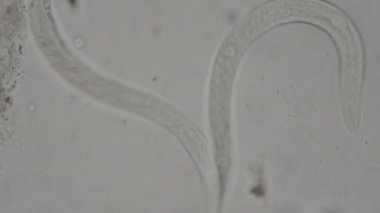 Strongyloides stercoralis mikroskop altında insan dışkısı. laboratuarda test ediliyor