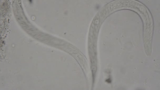 parasite : Strongyloides stercoralis provenant des matières fécales humaines au microscope. essais en laboratoire