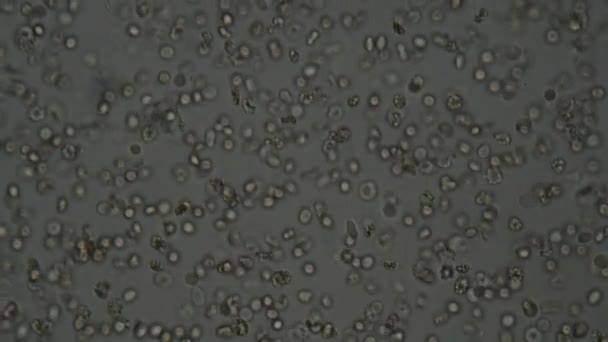 Células Sanguíneas Humanas Bajo Microscopio — Vídeos de Stock