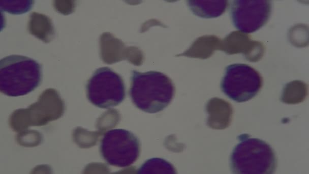 Cellule Del Sangue Umano Microscopio — Video Stock