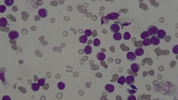Menselijke Bloedcel Onder Microscoop — Stockvideo