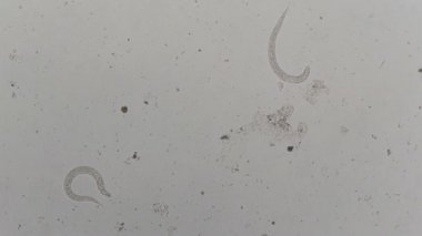Strongyloides stercoralis mikroskop altında insan dışkısı. laboratuarda test ediliyor