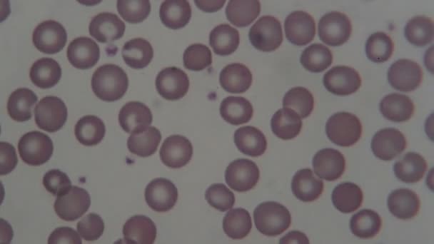 Menschliche Blutkörperchen Unter Dem Mikroskop — Stockvideo