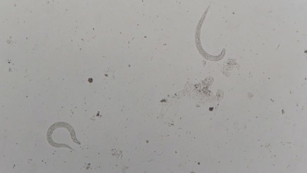 Parasite Strongyloides Stercoralis Human Feces Microscope Testing Laboratory — Stock Video