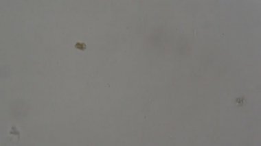 Parazit: trichuris trichiura yumurtası mikroskop altında insan dışkısı. laboratuarda test ediliyor