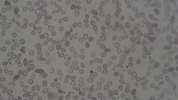 Cellule Del Sangue Umano Microscopio — Video Stock