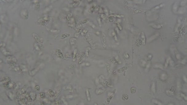 Sedimento Orina Humana Bajo Microscopio Laboratorio — Vídeos de Stock