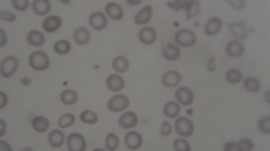 Mikroskop altında insan kan hücreleri