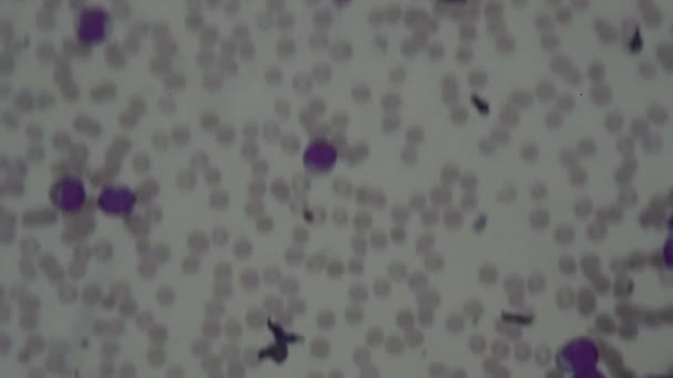 Human Blood Cells Microscope — Stock Video