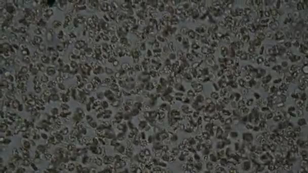 Клетки Крови Человека Микроскопом — стоковое видео