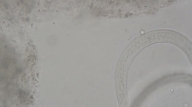 Strongyloides stercoralis mikroskop altında insan dışkısı. laboratuarda test ediliyor