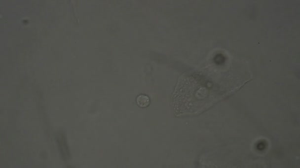 Humant Urinsediment Mikroskop Laboratorium — Stockvideo