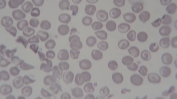 Human Blood Cells Microscope — Stock Video