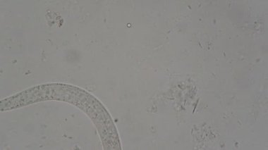 Strongyloides stercoralis mikroskop altında insan dışkısı. laboratuarda test ediliyor