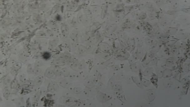 Menselijke Urine Sediment Onder Microscoop Laboratorium — Stockvideo