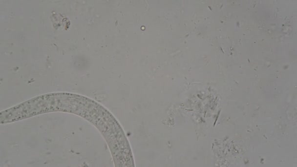 Parazit Strongyloidy Stercoralis Lidských Výkalů Pod Mikroskopem Testování Laboratoři — Stock video