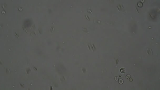 Células Sanguíneas Humanas Bajo Microscopio — Vídeo de stock