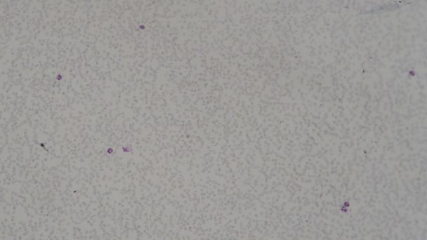 Cellule Ematiche Umane Microscopio — Video Stock