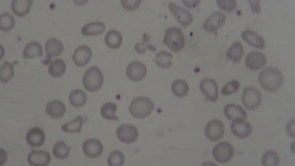 Human Blood Cells Microscope — Stock Video