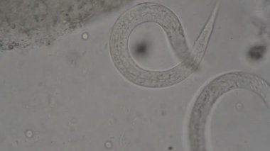 Strongyloides stercoralis mikroskop altında insan dışkısı. laboratuarda test ediliyor