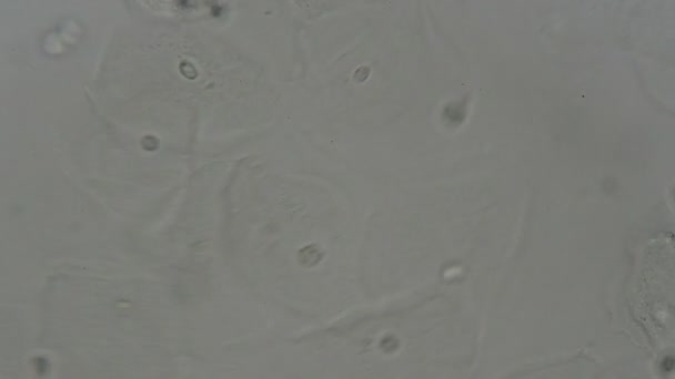 Humant Urinsediment Mikroskop Laboratorium — Stockvideo