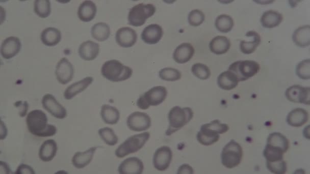 Human Blood Cells Microscope — Stock Video