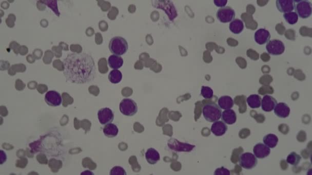 Menselijke Bloedcellen Onder Microscoop — Stockvideo