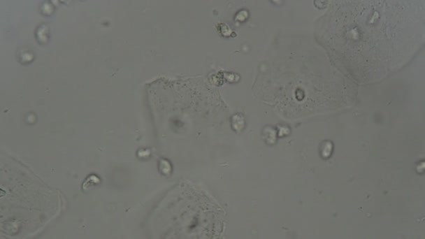 实验室显微镜下人体尿沉淀物 — 图库视频影像