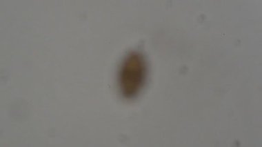 Parazit: trichuris trichiura mikroskop altında insan dışkısı. laboratuarda test ediliyor
