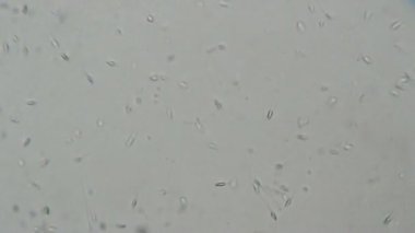 Mikroskop altında insan spermi. Laboratuvarda test ediliyor.