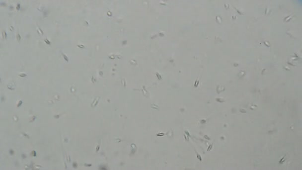 Human Spermatozoa Microscope Testing Laboratory — Stock Video