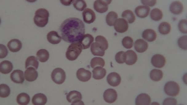 Mikroskop Altında Insan Kan Hücreleri — Stok video