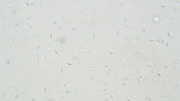 Lidské Spermie Pod Mikroskopem Testování Laboratoři — Stock video