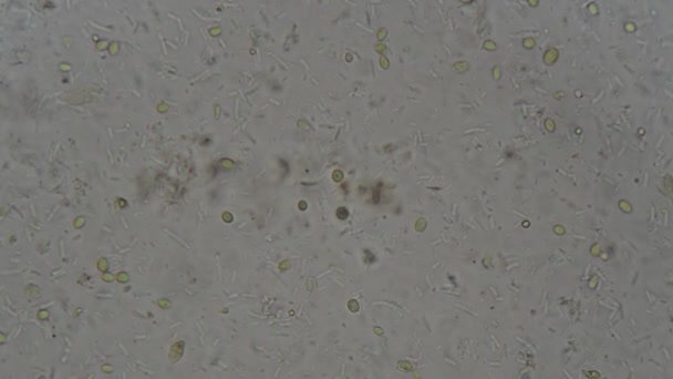 实验室显微镜下人体尿沉淀物 — 图库视频影像
