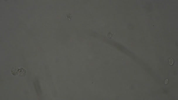 실험실에서 현미경으로 인간의 침전물 — 비디오