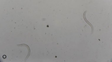 Strongyloides stercoralis mikroskop altında insan dışkısı. laboratuarda test ediliyor