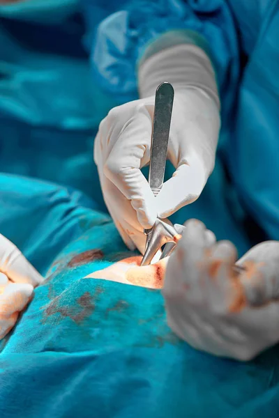 На носі працює хірург з рукавичками. Ринопластика, крупним планом операція. Блакитне світло, командна робота, здоров'я, краса . — стокове фото